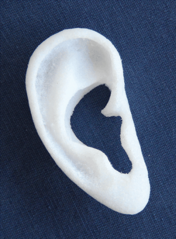 Surgery_blue ear