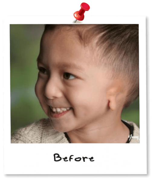 before_cp