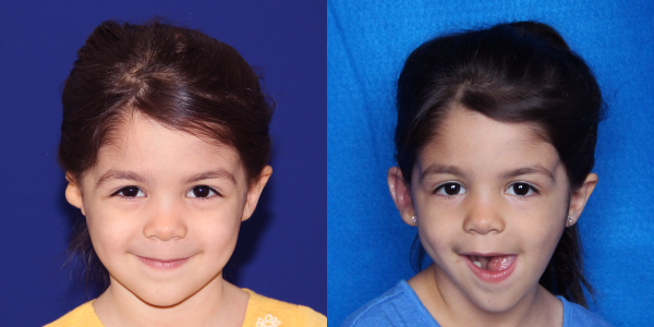 1_AVA_B&A_4MOAP