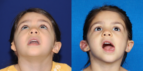2_AVA_B&A_4MOPOST_BEYE