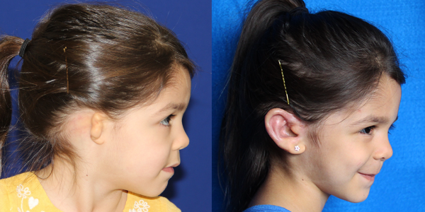 4_AVA.B&A_4MOPOST_RLAT