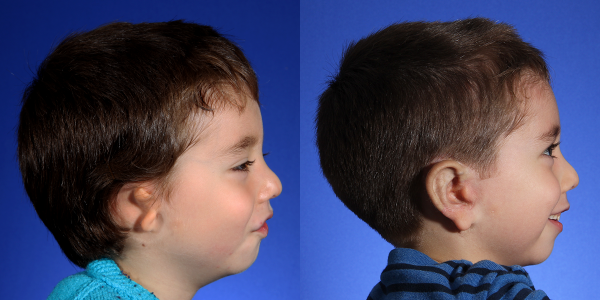 4_SB_B&A_RLAT