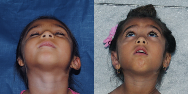 ALIYAH_B&A_BEYE