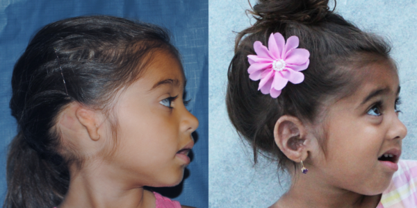 ALIYAH_B&A_RLAT