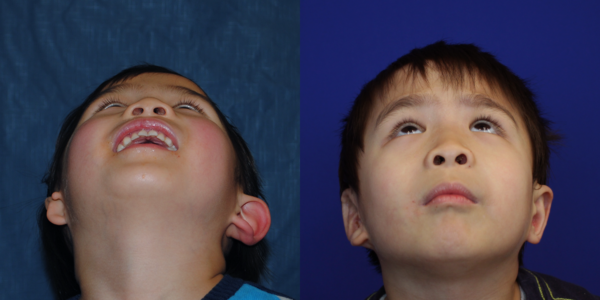 COLIN_B&A_BEYE