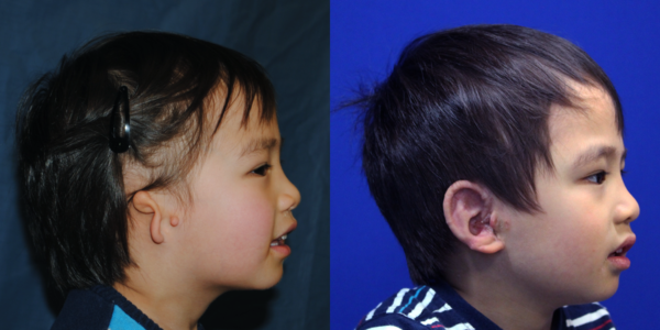 COLLN_B&A_RLAT