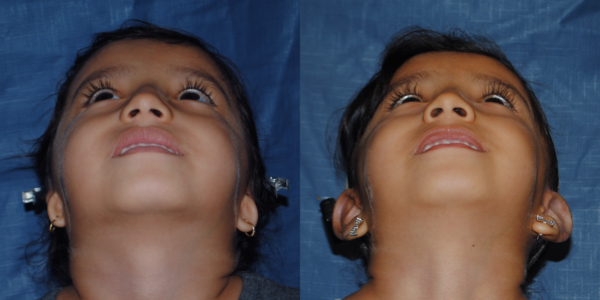 DANNA_B&A_BEYE