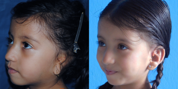 DANNA_B&A_LLAT
