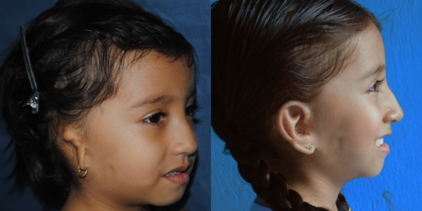 DANNA_B&A_RLAT