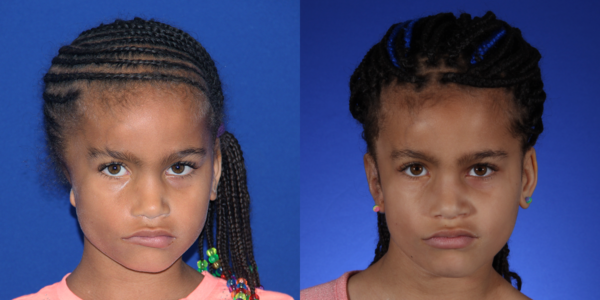 ELLA_B&A_AP