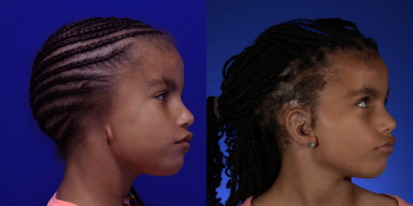 ELLA_B&A_RLAT