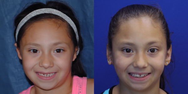 ILLIANA_B&A_AP