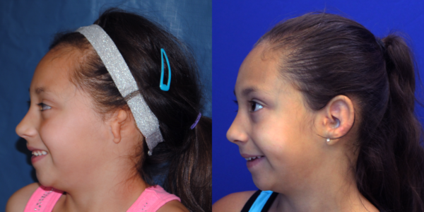 ILLIANA_B&A_LLAT