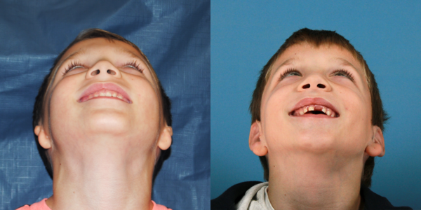 JOEY_B&A_BEYE