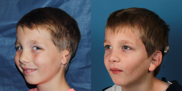JOEY_B&A_L34