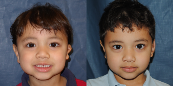 KEENAN_B&A_AP