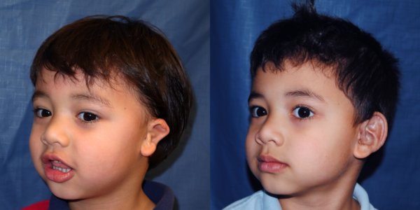 KEENAN_B&A_L34