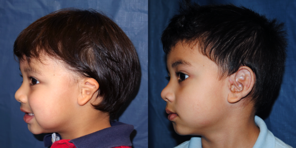 KEENAN_B&A_LLAT