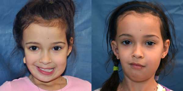 KIERA_B&A_AP