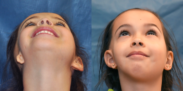 KIERA_B&A_BEYE