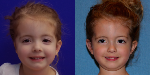 LAUREN_B&A_AP
