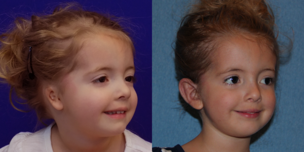 LAUREN_B&A_R34
