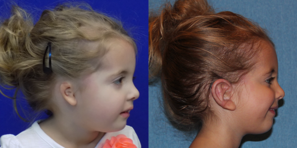 LAUREN_B&A_RLAT