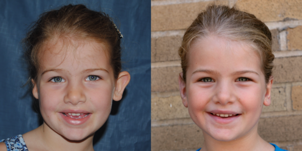 LINDSEY_B&A_AP