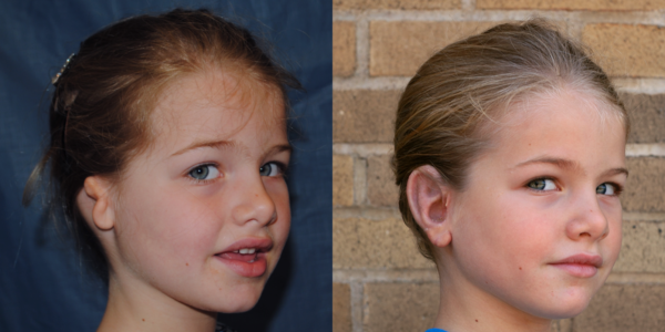 LINDSEY_B&A_R34