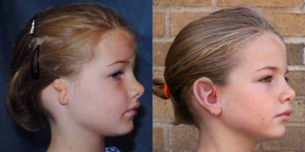 LINDSEY_B&A_RLAT