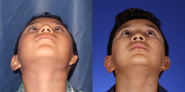 LOUIS_B&A_BEYE