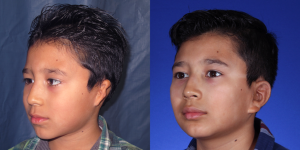 LOUIS_B&A_L34