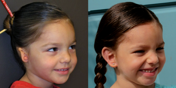 NEABELLA_B&A_R34