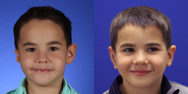 NOAH_B&A_AP