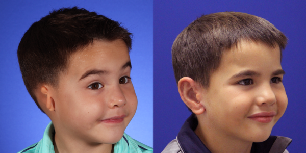 NOAH_B&A_R34