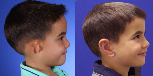 NOAH_B&A_RLAT