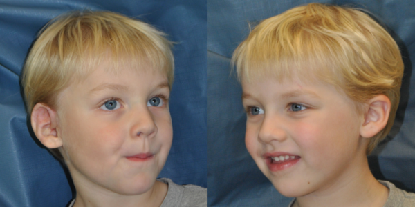 OWEN B_AFTER_R_34