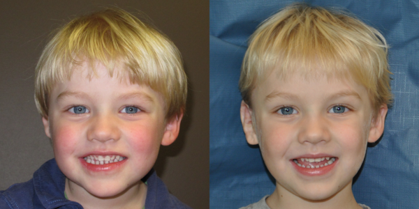 OWEN-B_B&A_AP