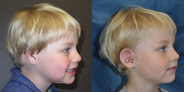OWEN-B_B&A_RLAT