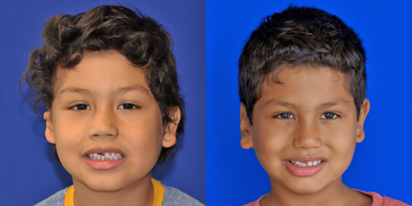 RAM_B&A_AP