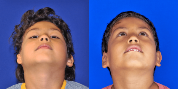 RAM_B&A_BEYE