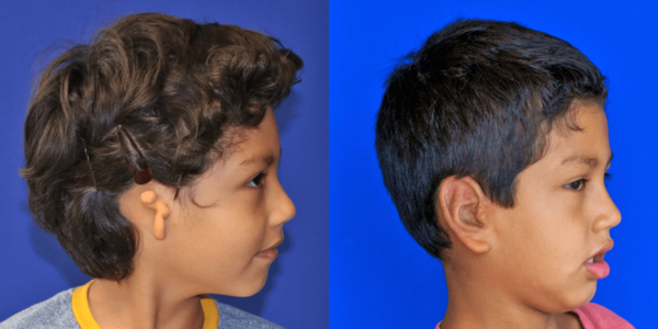RAM_B&A_RLAT