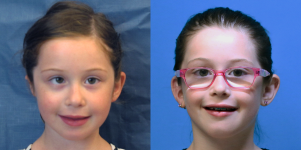 RUBY_B&A_AP