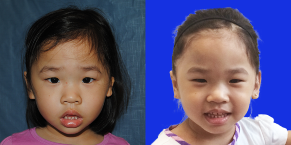 SOPHIE_B&A_AP