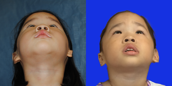 SOPHIE_B&A_BEYE