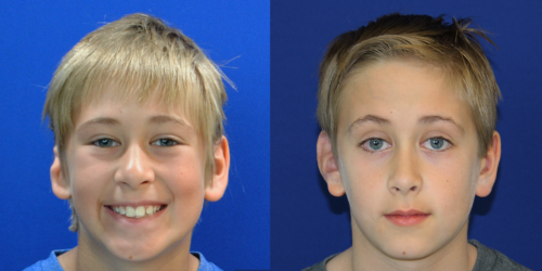 WYATT_B&A_AP