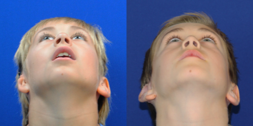 WYATT_B&A_BEYE