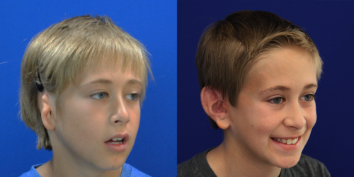 WYATT_B&A_R34