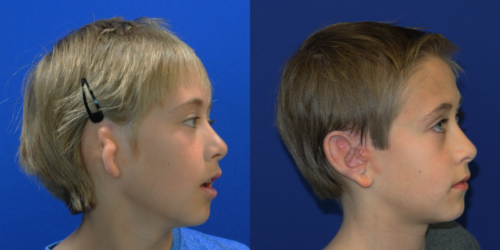 WYATT_B&A_RLAT