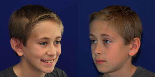 WYATT_after_34